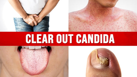 Conquer Candida Naturally with These Powerful Herbs