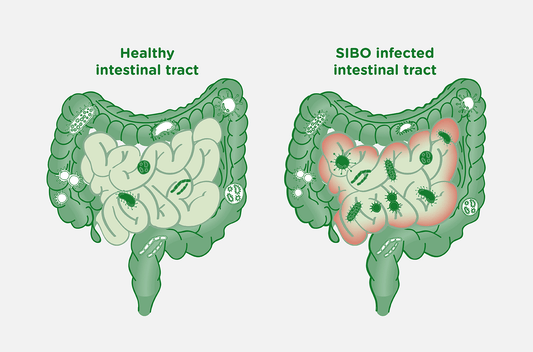 Understanding Chronic Anemia and Small Intestinal Bacterial Overgrowth (SIBO): How to Heal and Restore Gut Health