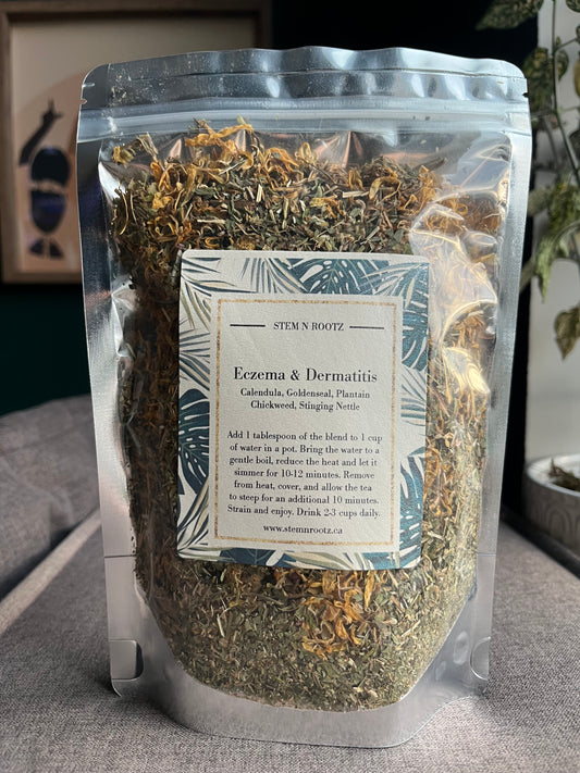 Eczema & Dermatitis Support – Herbal Relief for Irritated and Sensitive Skin 3oz